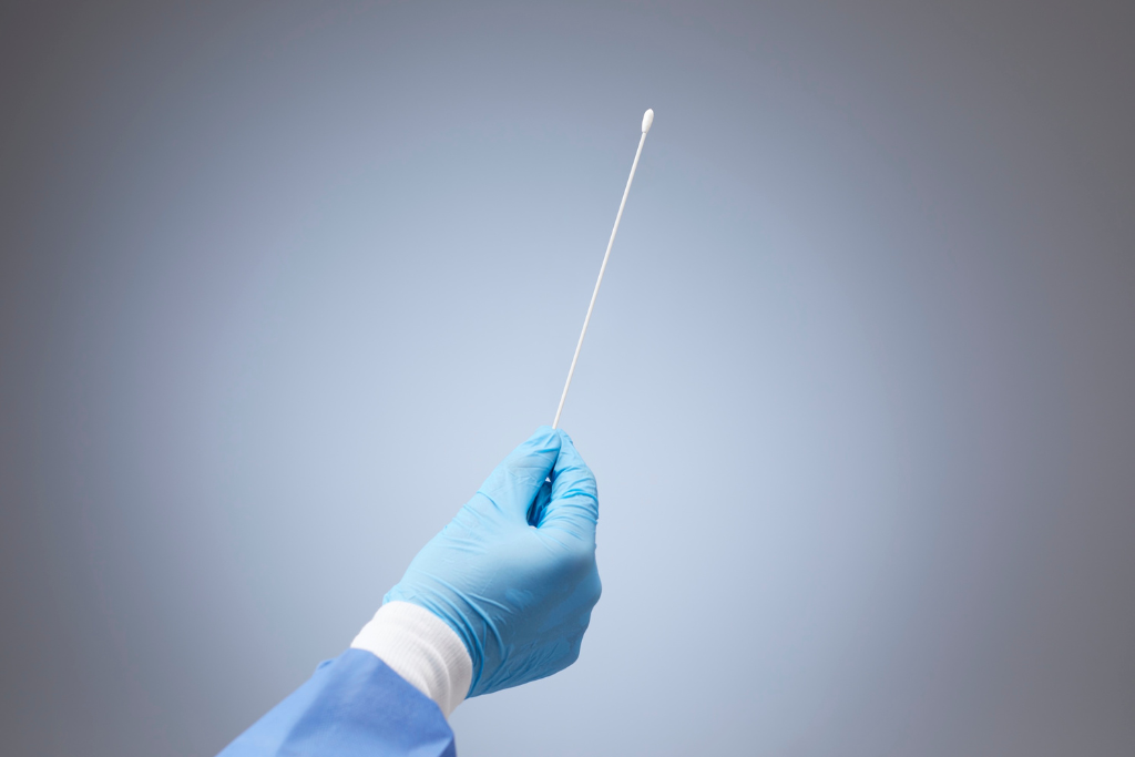 Doctor holding sterile swab used for ureaplasma testing through urine or genital sample collection.