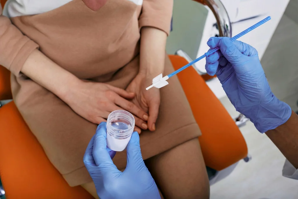 Doctor preparing cervical cell collection for an HPV test to detect high-risk virus strains.