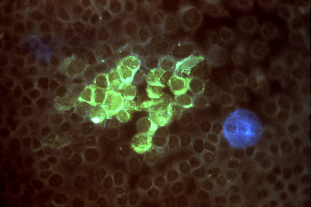 Fluorescent microscopy image of herpes virus cells used in pcr dna testing for genital herpes.