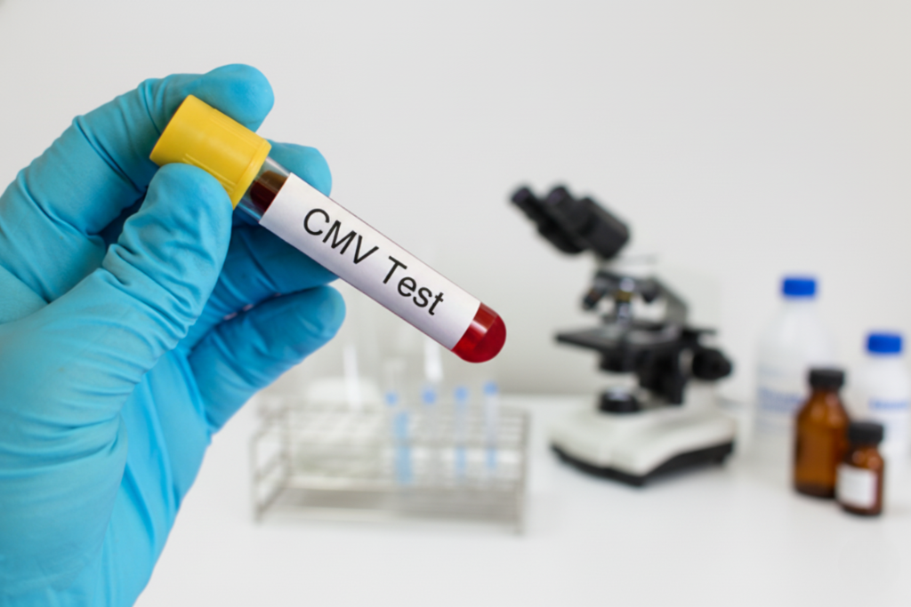 Laboratory staff holding CMV blood test tube for cytomegalovirus diagnosis