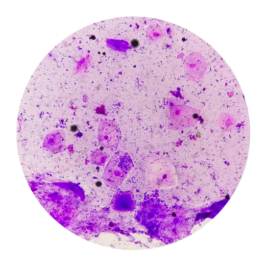 Microscopic view of Gardnerella vaginalis bacteria that can cause bacterial vaginosis in women